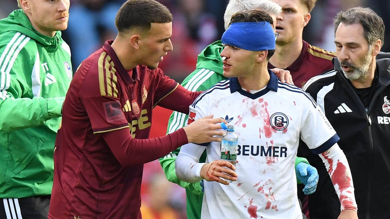 Blutiger Zusammenprall bei Nullnummer in Köln