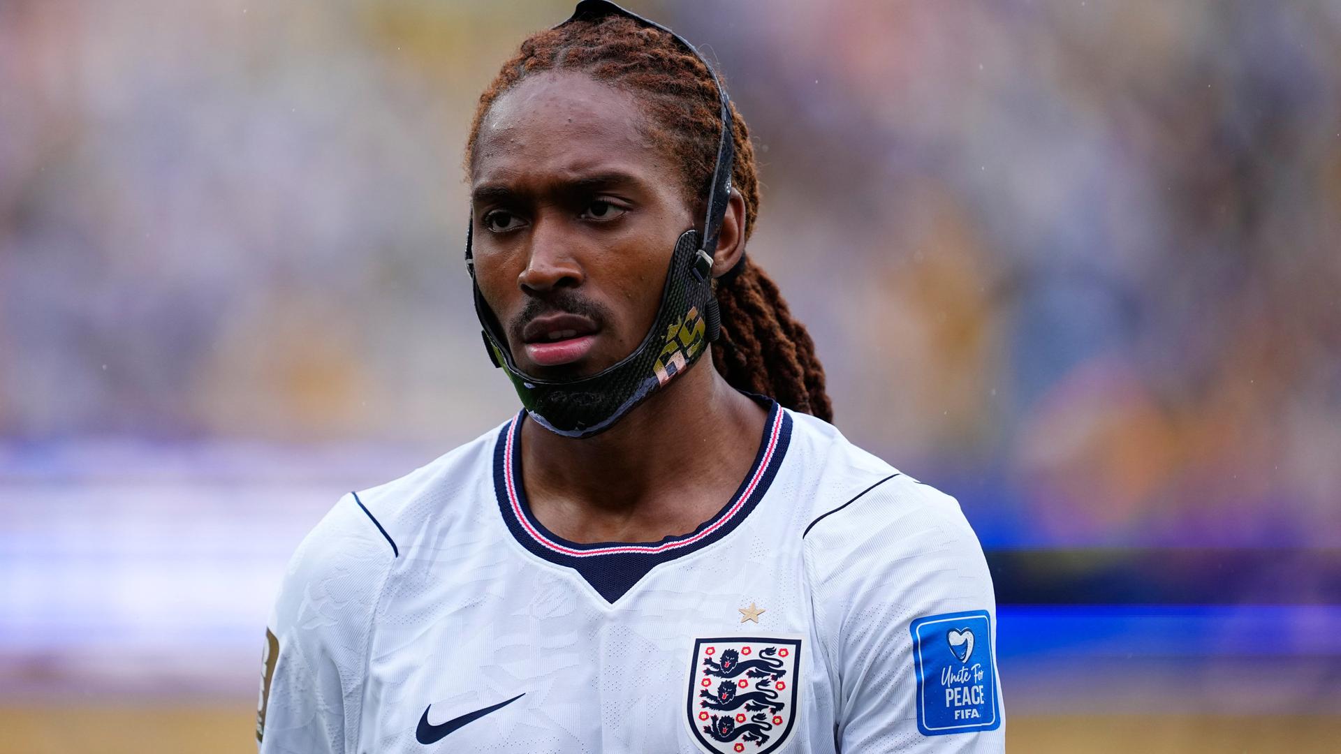 WM 2026: Spence verweigert Partey den Handschlag